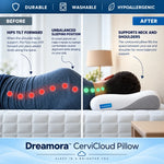 Dreamora™ CerviCloud Pillow